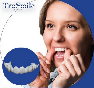 Накладные зубы виниры TruSmile на верхнюю челюсть ( арт 9-7860 )
